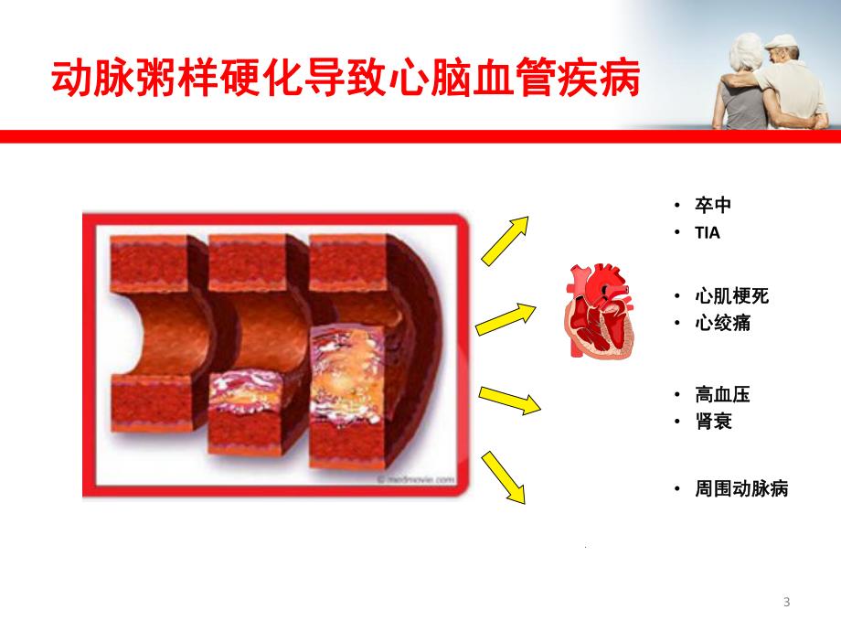 控制血脂与防范心脑血管疾病.ppt_第3页