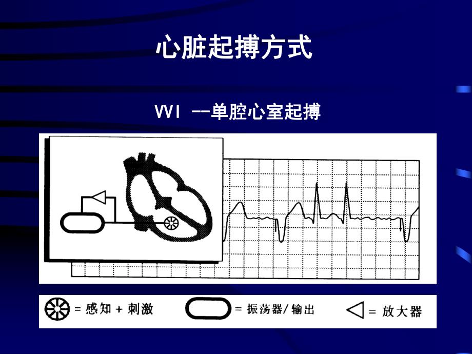 心脏起搏器适应证与应用.ppt_第3页