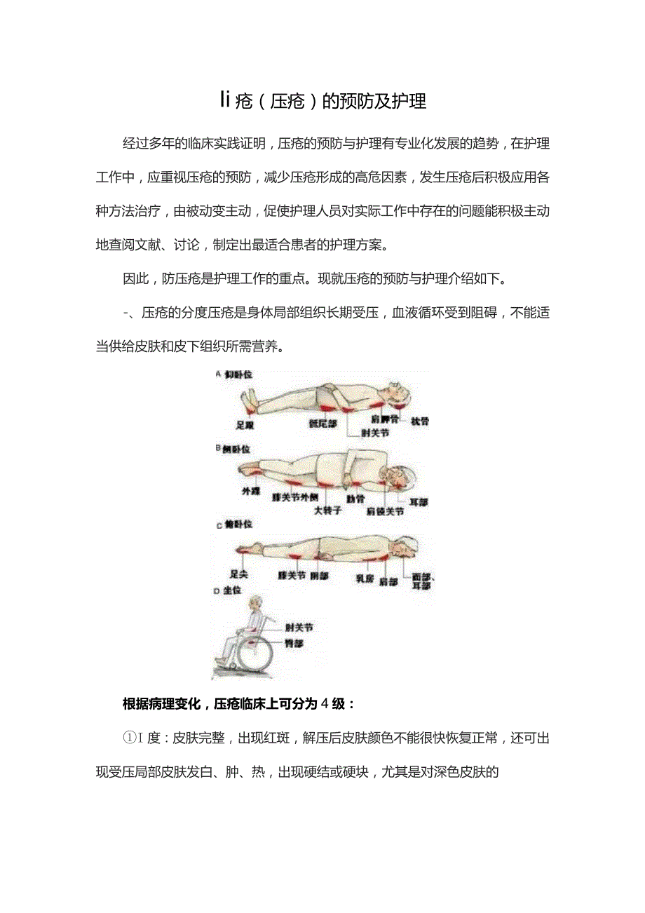 褥疮(压疮)的预防及护理.docx_第1页