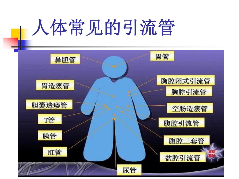 普外科各种引流管的护理1.ppt_第2页