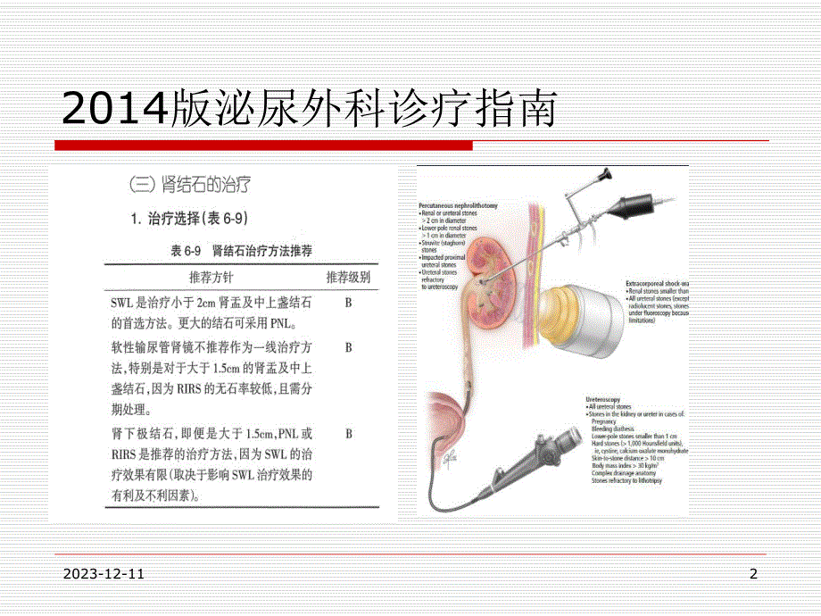 输尿管软镜.ppt_第2页