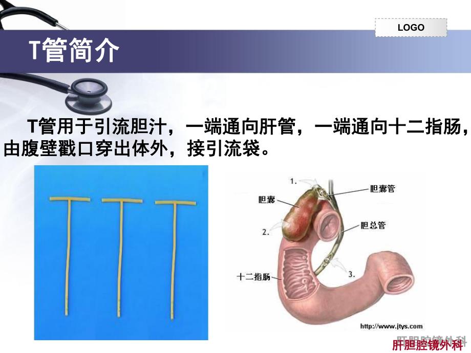 肝胆腔镜外科留置t管的护理.ppt_第3页