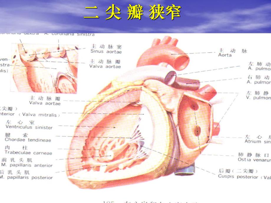 瓣膜置换术后监护.ppt_第3页