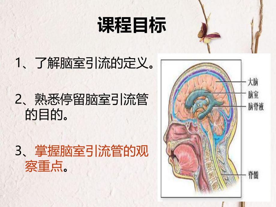 脑室引流管的观察重点.ppt_第2页