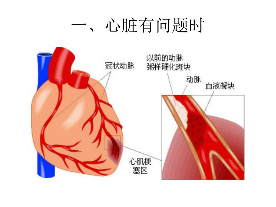 你最容易忽视的8类身体求救信号.ppt_第2页