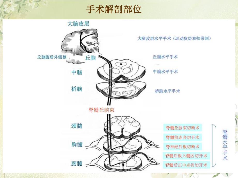 慢性疼痛的神经外科治疗.ppt_第3页