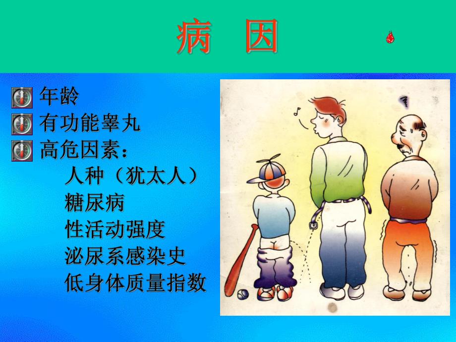 良性前列腺增生ppt.ppt_第2页