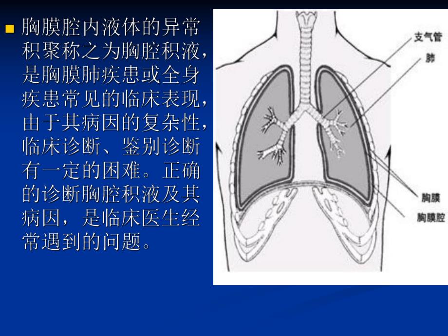 胸腔积液诊断进展.ppt_第2页