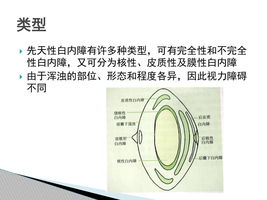 先天性白内障.ppt_第3页