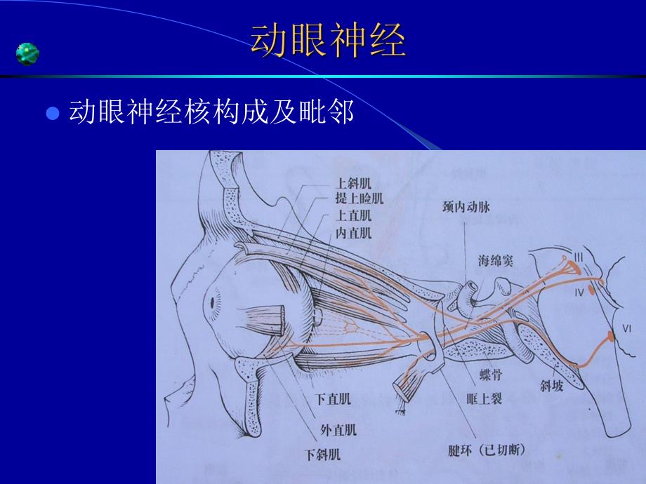 眼肌麻痹.ppt.ppt_第3页