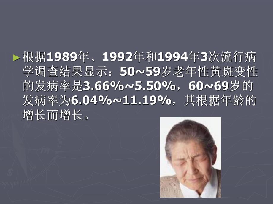 老性黄斑变性.ppt_第3页