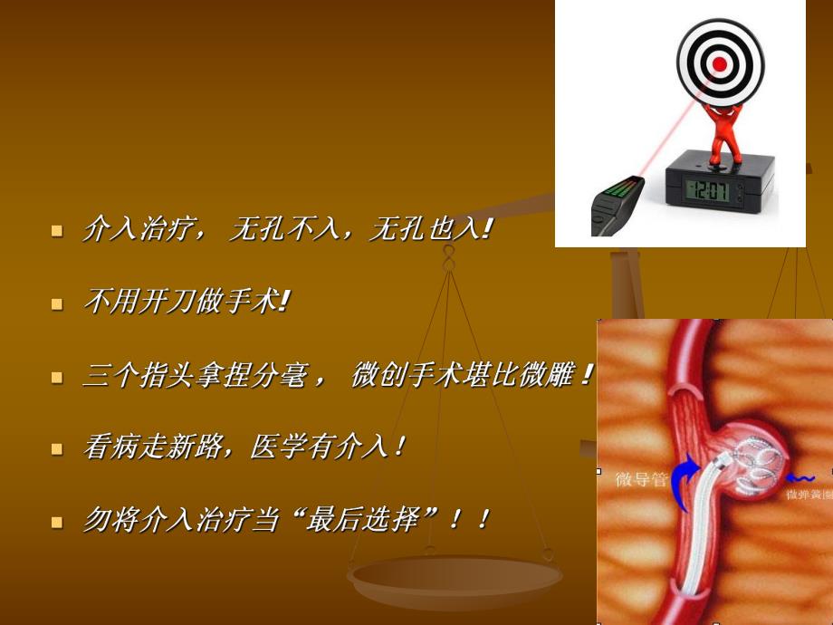 介入医学.ppt.ppt_第2页