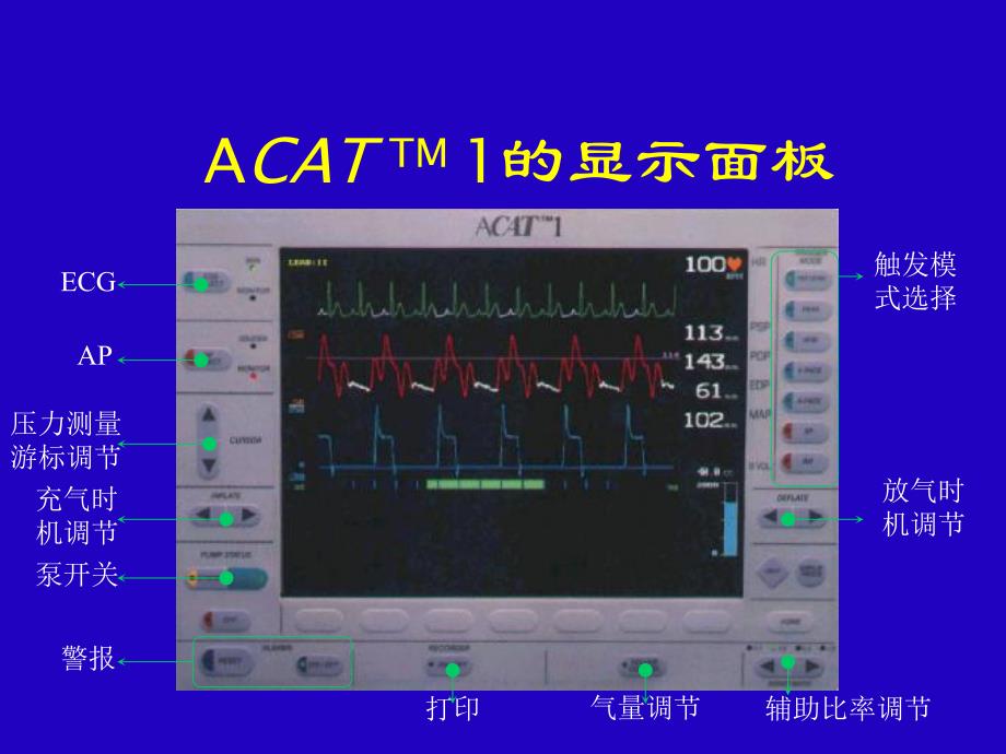 主动脉内球囊反搏泵产品介绍PPT.ppt_第3页