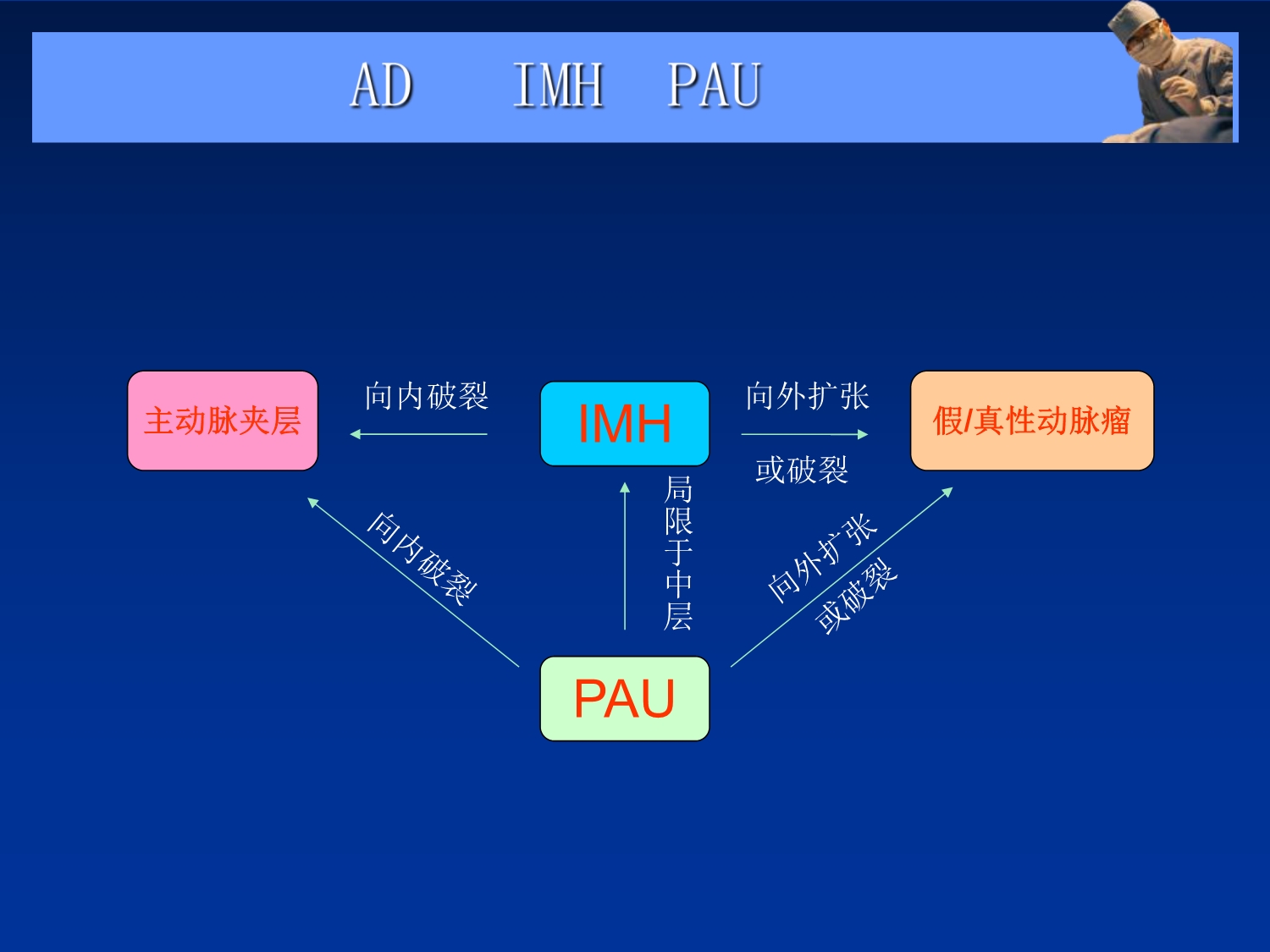 主动脉夹层、壁间血肿及穿通性溃疡.ppt_第3页