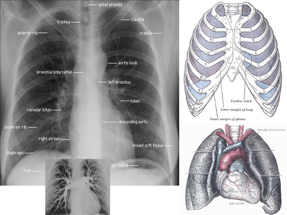 医院专题讲座：胸部影像基础.ppt_第3页