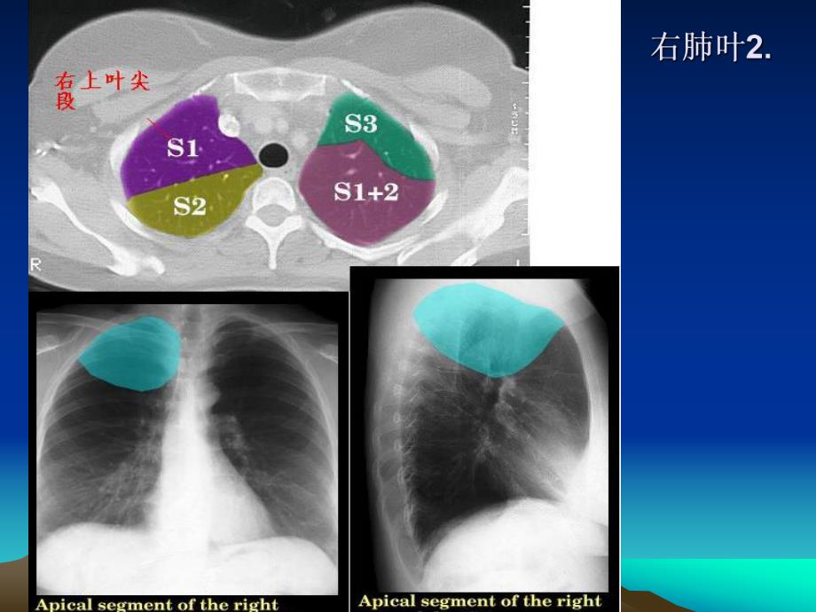 正常肺部CT彩色解剖图谱.ppt_第3页