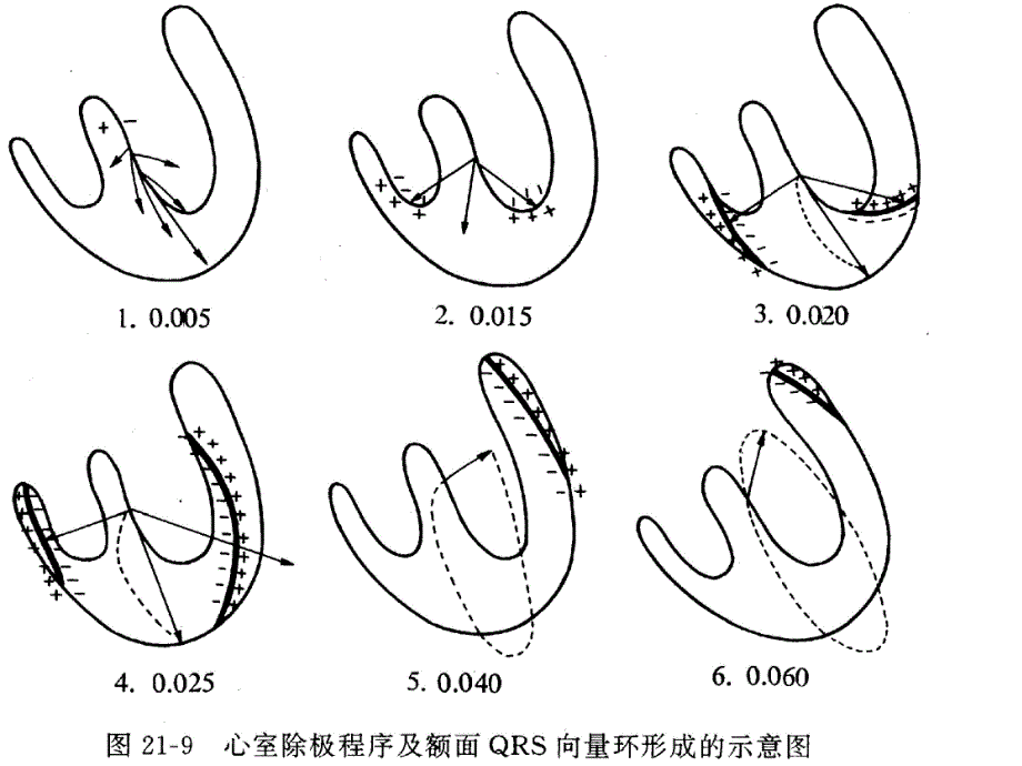 [临床医学]心电图图谱.ppt_第2页