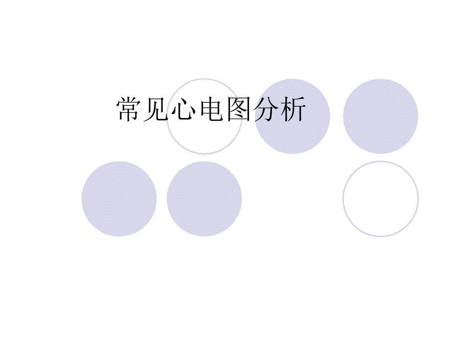 常见心电图分析.ppt_第1页