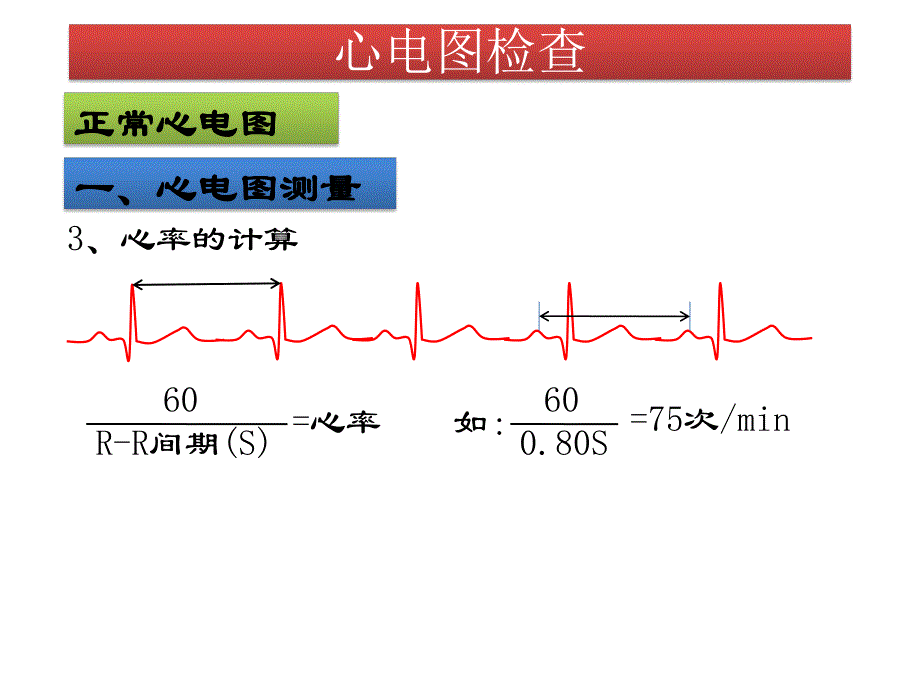 心电图检查.ppt_第3页