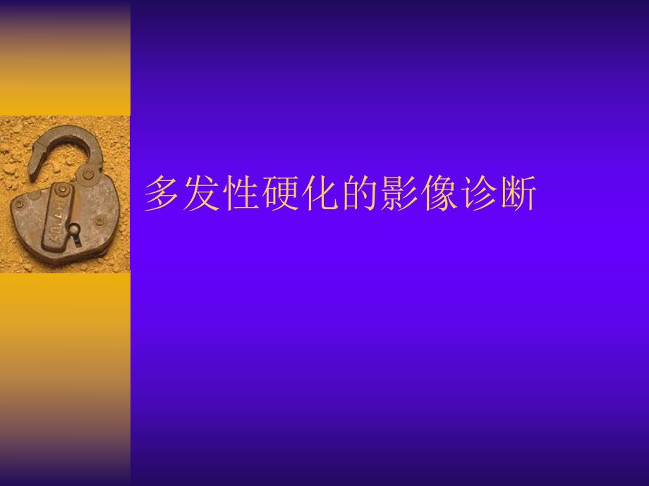 多发性硬化的影像诊断.ppt_第1页