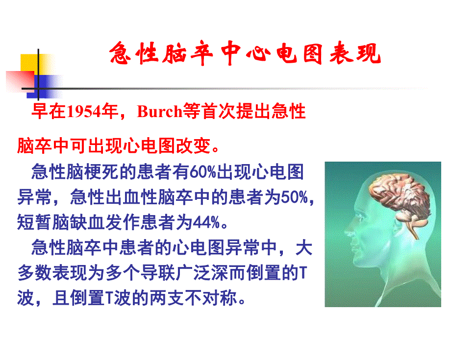 急性脑卒中心电图表现.ppt_第3页