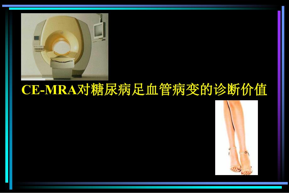 CEMRA对糖尿病足血管病变的诊断价值.ppt_第1页