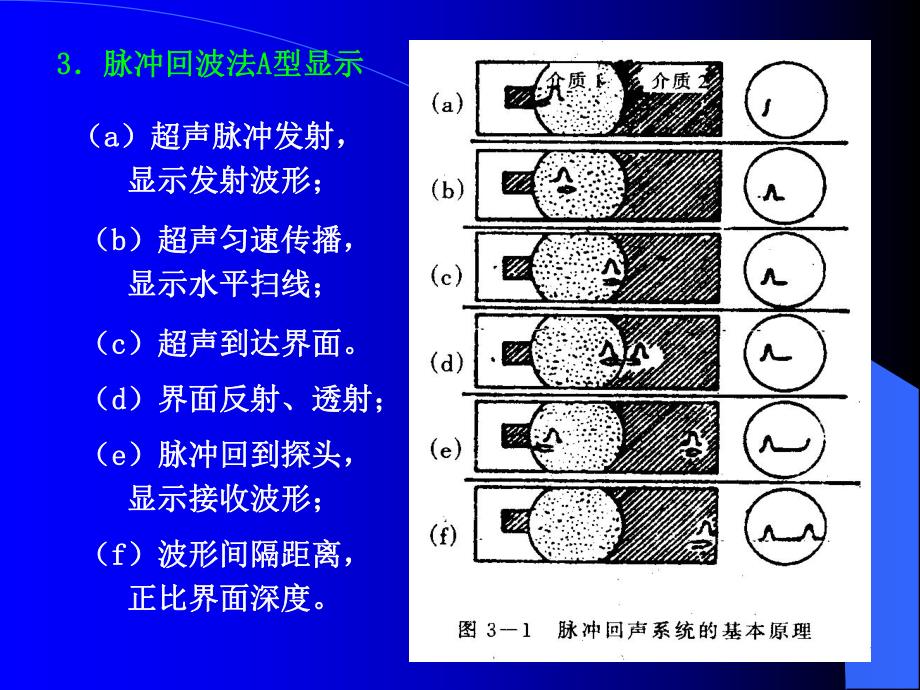 医学超声成像的基本原理.ppt_第2页