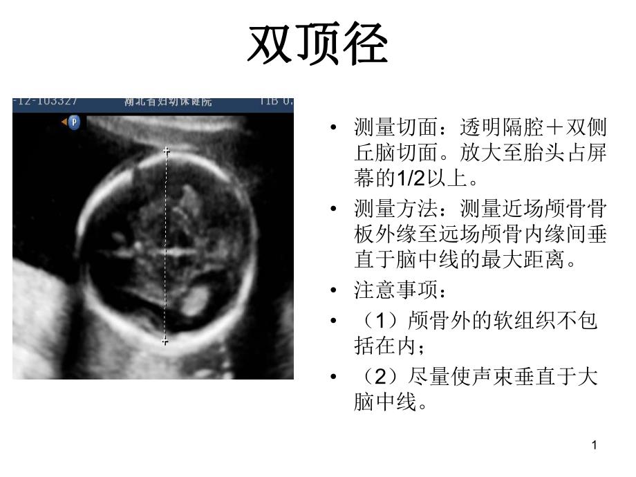 产科超声标准切面25张图.ppt_第1页