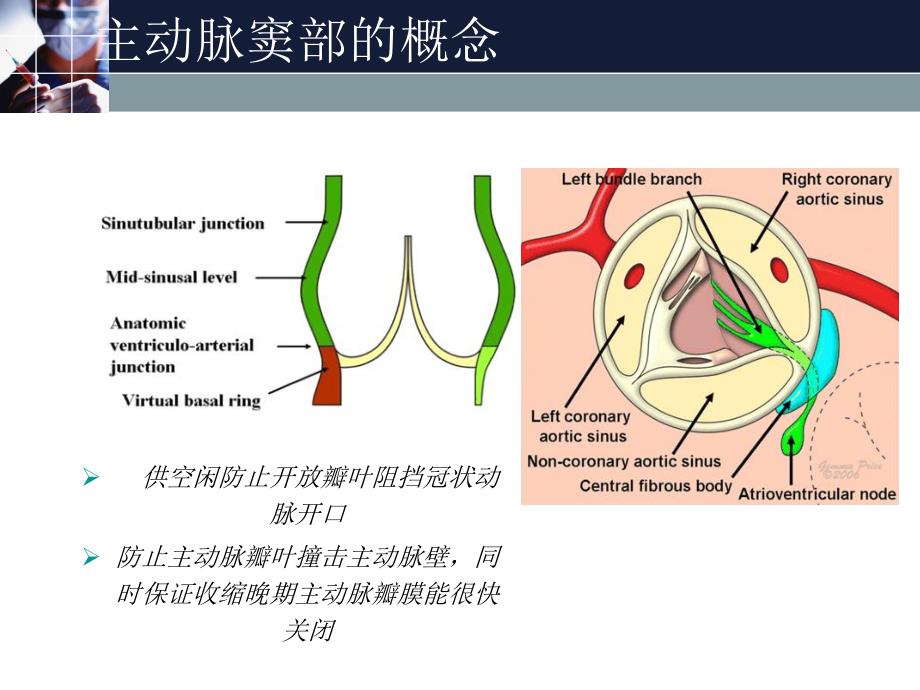 主动脉窦动脉瘤.ppt_第3页