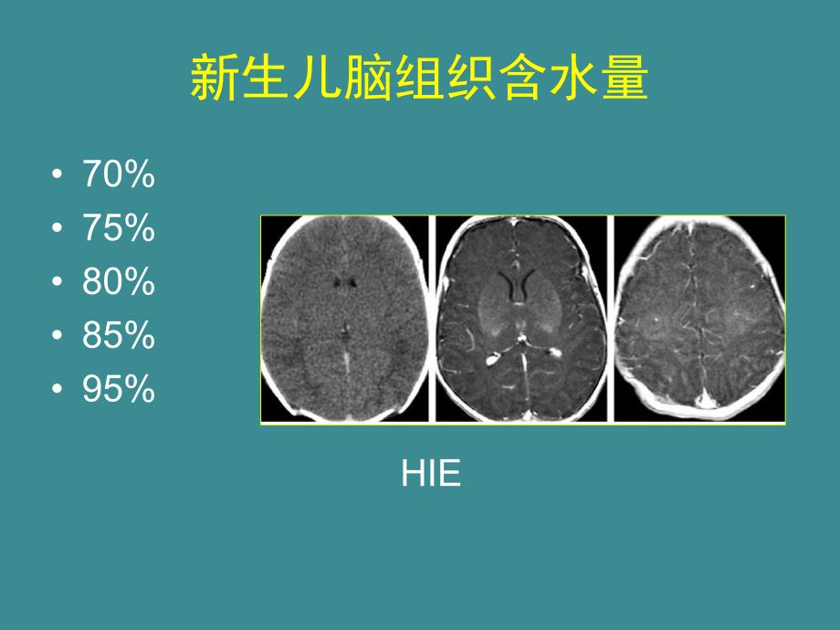 儿童神经影像诊断.ppt_第3页