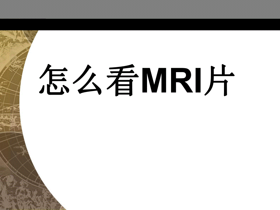 医院培训课件：怎么看MRI片.ppt_第1页