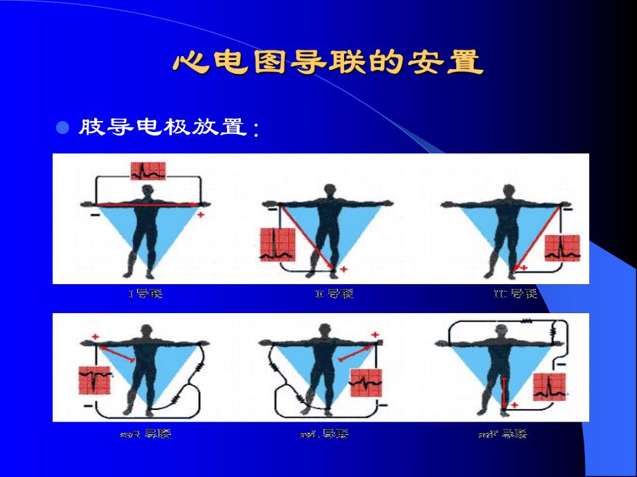 心电图浅析.ppt_第3页