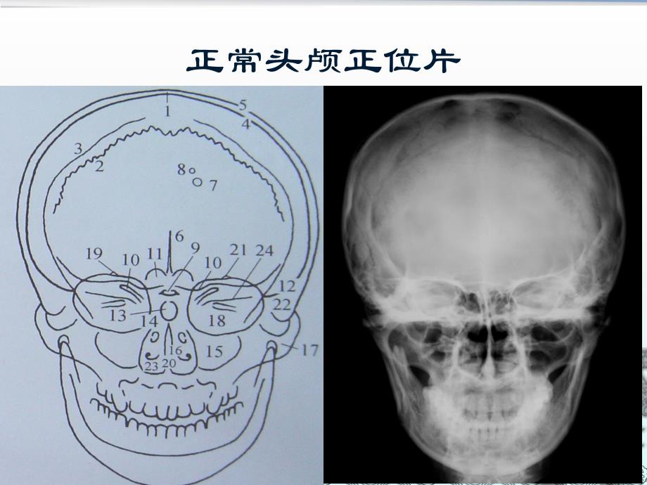 神经系统影像学诊断.ppt_第3页