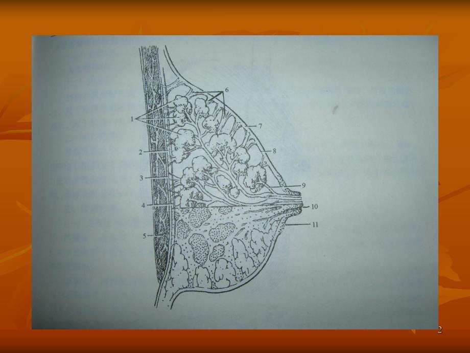 乳腺超声诊断.ppt_第2页