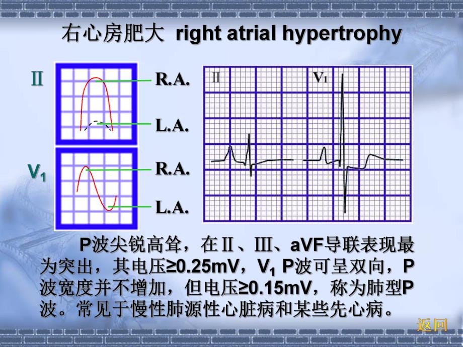 心电图中.ppt_第2页