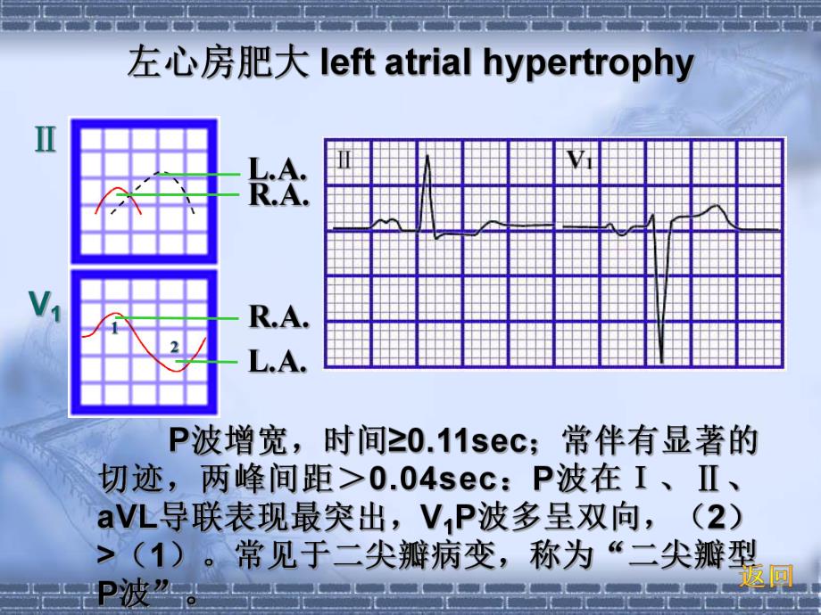 心电图中.ppt_第3页