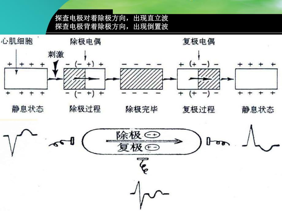 心电图与常见急救药品的应用.ppt_第3页