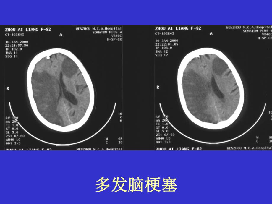 CT实习片.ppt_第2页