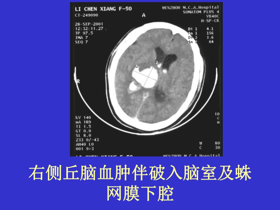 CT实习片.ppt_第3页