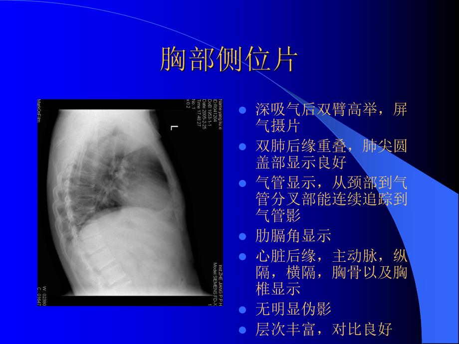 医院放射科常规投照位置检查规程和质量控制标准.ppt_第3页