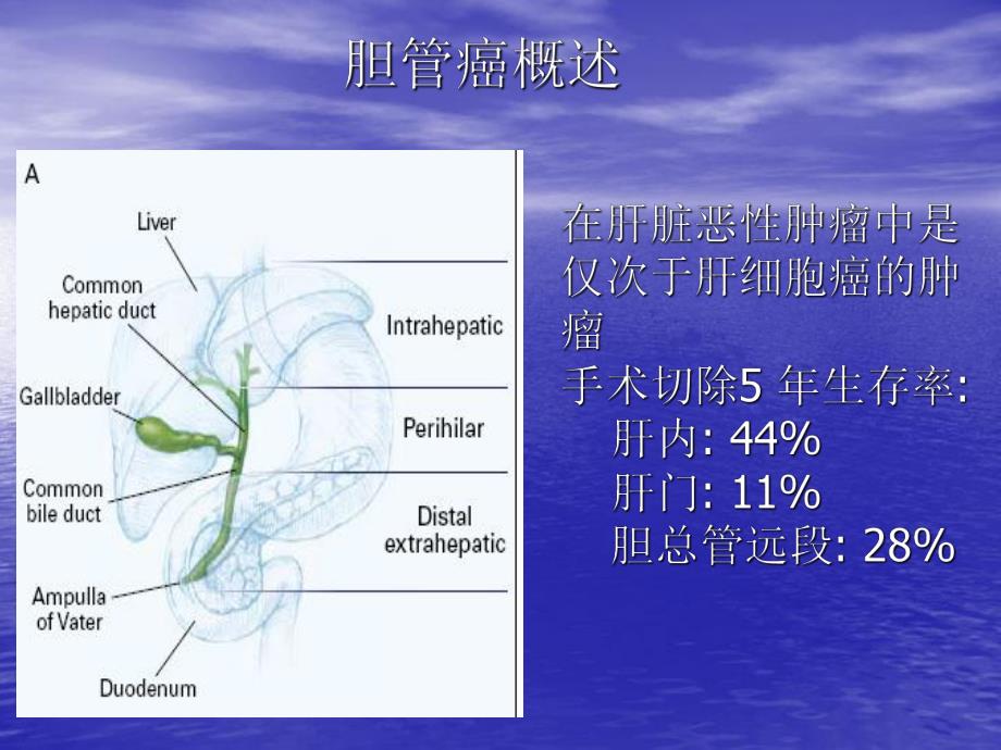 胆管癌的CT诊断.ppt_第2页