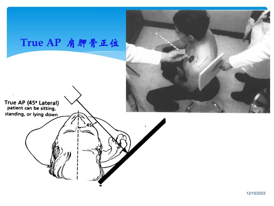 肩关节影像学及特殊检查..ppt_第3页