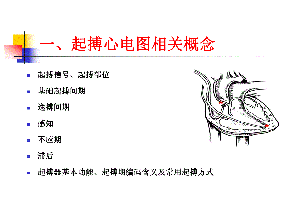 起搏心电图基础.ppt_第2页