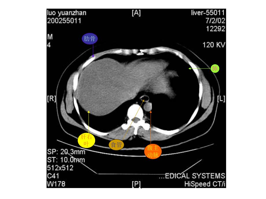 腹部CT专题培训教学PPT.ppt_第2页