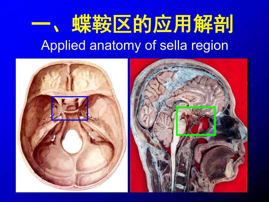 蝶鞍区应用解剖.ppt_第1页