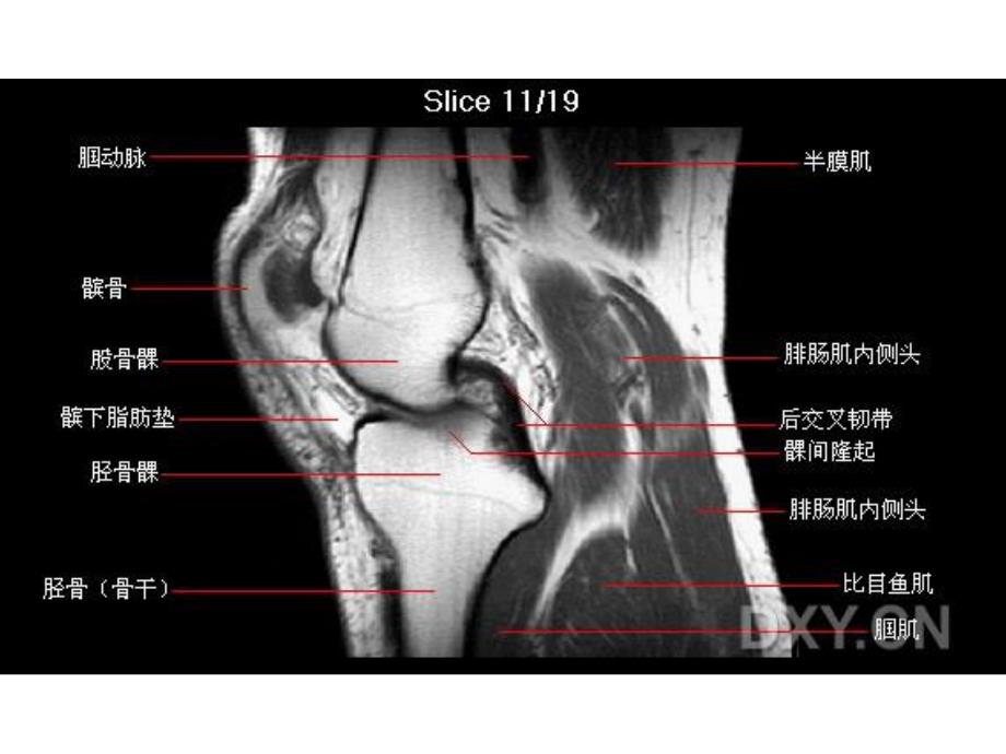 膝部MRI解剖.ppt_第1页