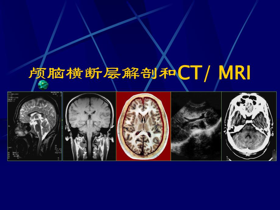 颅脑横断层解剖和CT、MRI.ppt_第1页