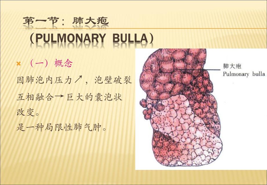 肺部疾病.ppt.ppt_第3页