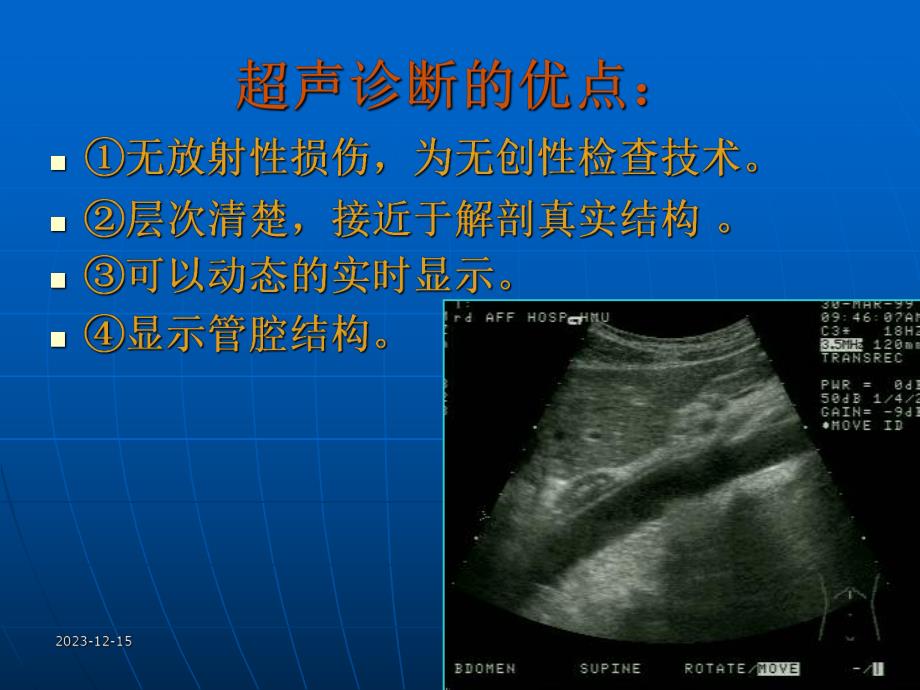 超声诊断学一绪论.ppt_第3页