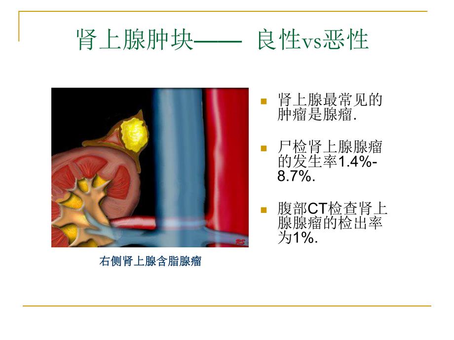 肾上腺肿块的鉴别诊断.ppt.ppt_第3页